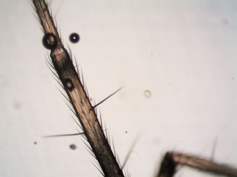 Quills can migrate, which is why removal matters