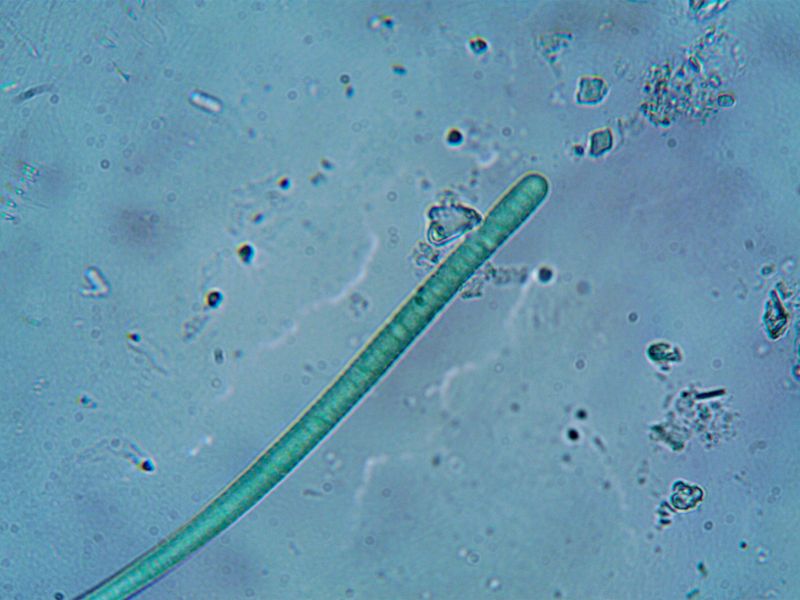 What Blue-Green Algae Actually Is