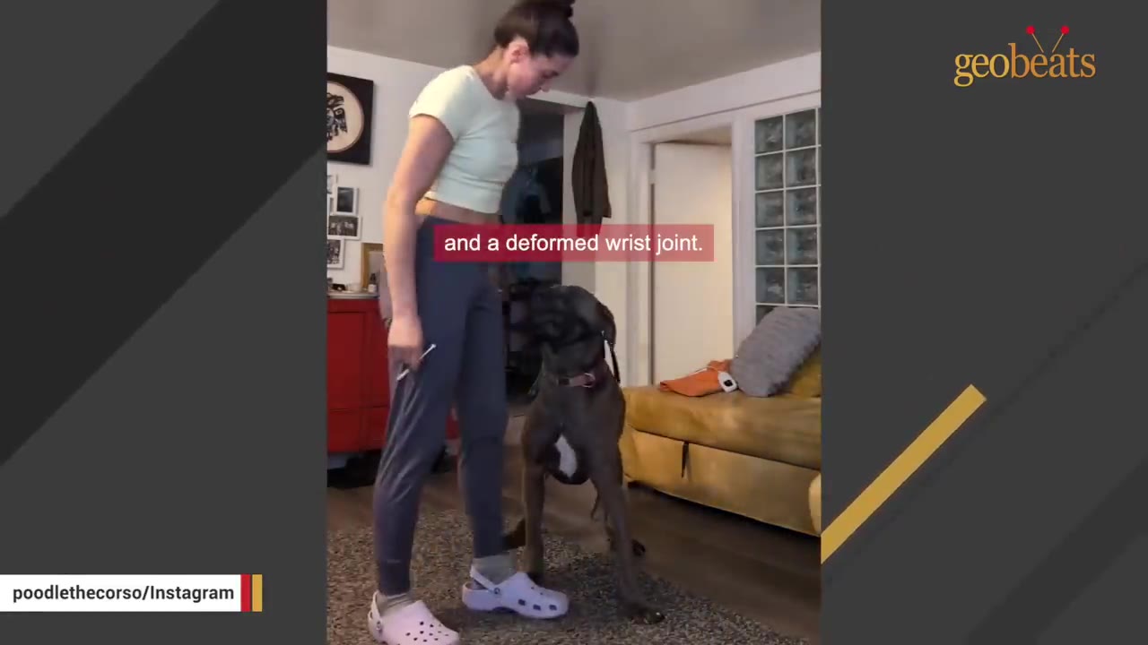 A woman stands next to a large brown dog in a living room, with a text overlay that reads 'and a deformed wrist joint.'