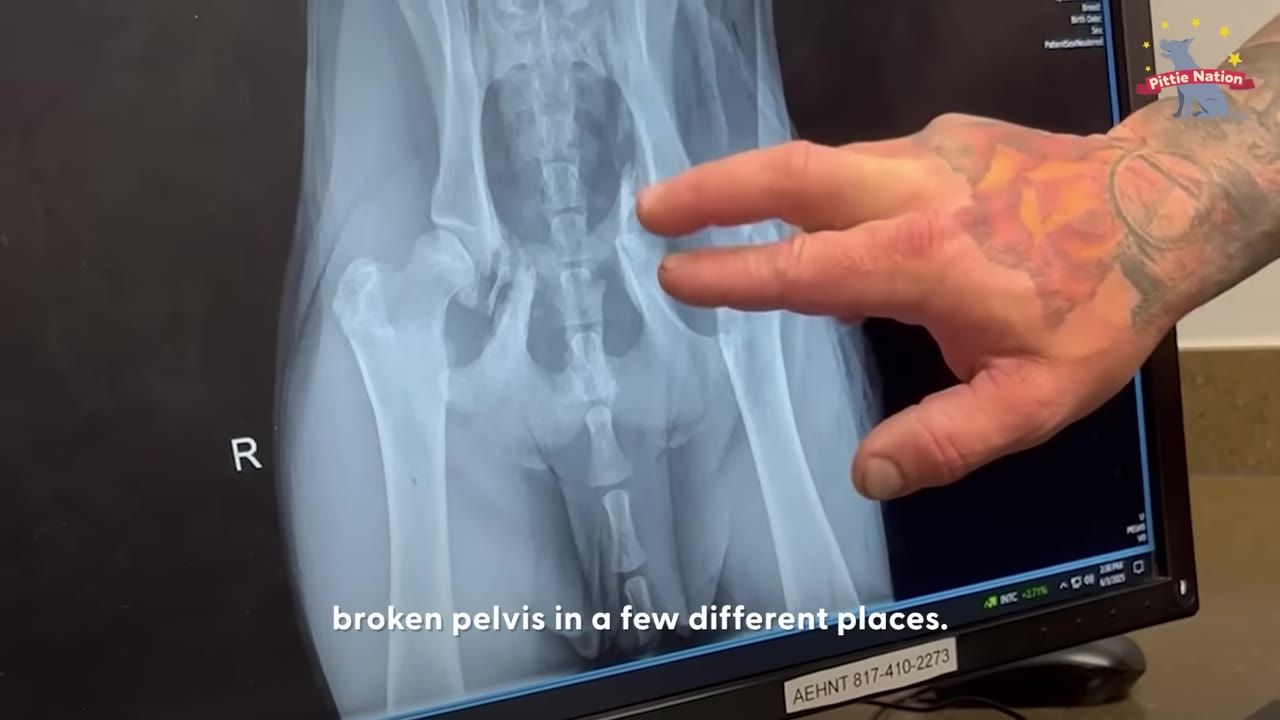 A close-up of a computer monitor displaying a dog's pelvic X-ray, with a tattooed hand pointing to a fracture in the bone.